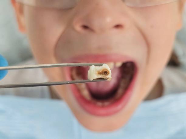 Best Emergency Orthodontic Services in New Cordell, OK