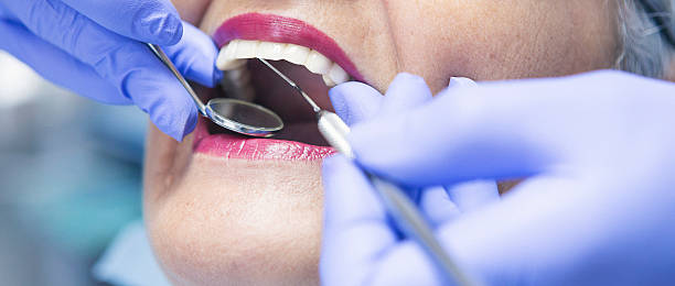 Best Emergency Wisdom Teeth Removal in New Cordell, OK
